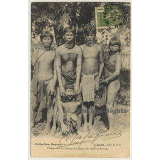 Laos: L'Operation Du Limage De Dents / Khas-Kaseng (Vintage PC 1907 Ethno)