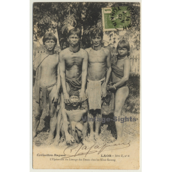 Laos: L'Operation Du Limage De Dents / Khas-Kaseng (Vintage PC 1907 Ethno)