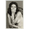 Close-Up Of Southern Nude / Hairy Arms - Almond Eyes (Vintage Amateur Photo)