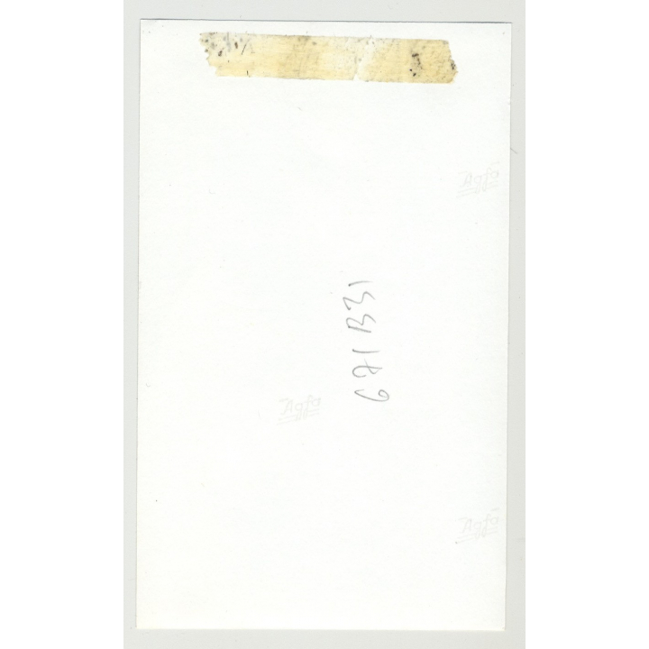 Close-Up Of Southern Nude / Hairy Arms - Almond Eyes (Vintage Amateur Photo)