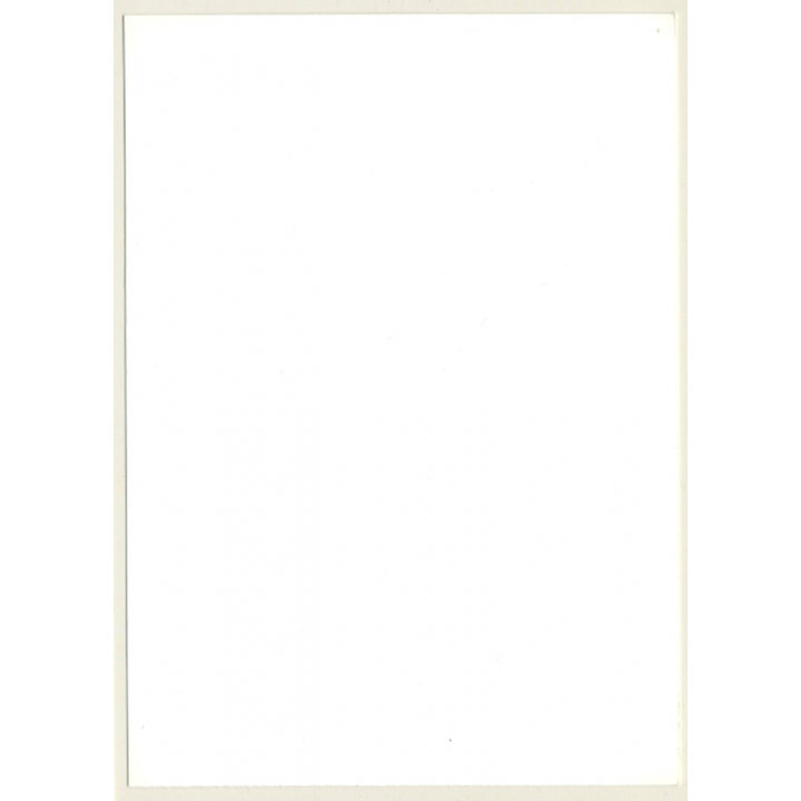 Natural Semi Nude Curlyhead Dries Armpits / Suspenders - Fishnets (Vintage Photo GDR ~1980s)