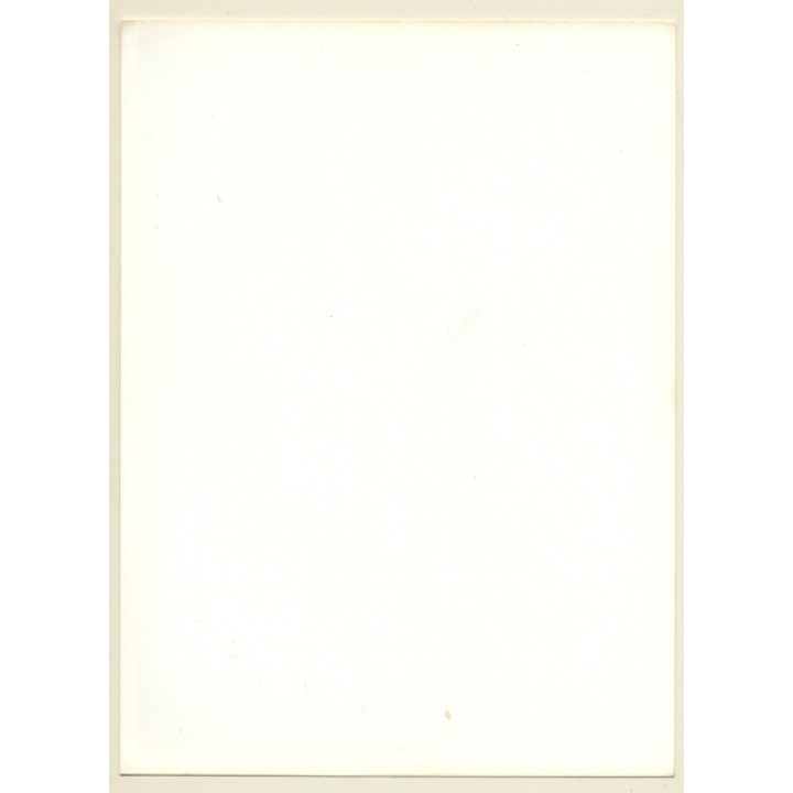 Artistic Erotic Study: Female Feet & Toes On Plexiglass*3 (Vintage Photo France B/W ~1980s)