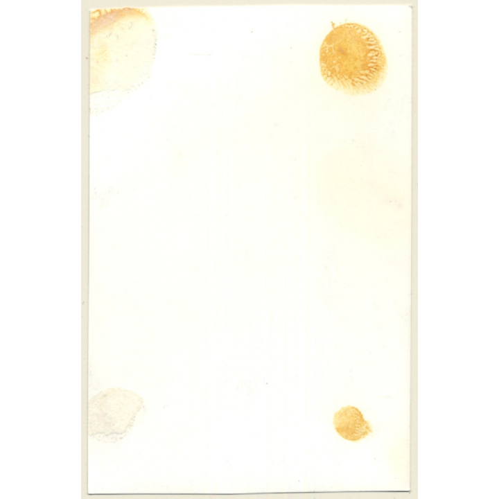 Darkhaired Semi Nude On Meadow / Striped Dress (Vintage Photo ~1950s/1960s)