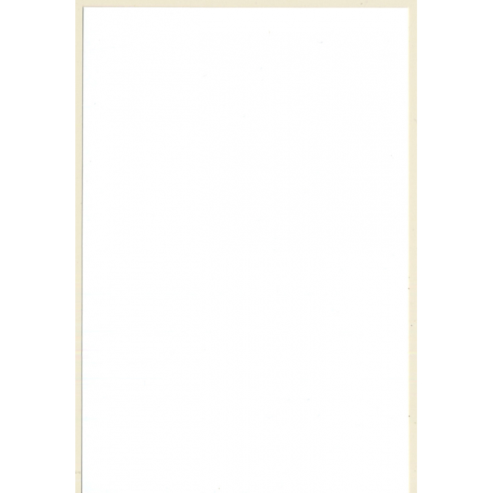 Erotic Study: Brunette Nude Getting Touched By Sunbeams*1(Digital Photo Print 2000s)