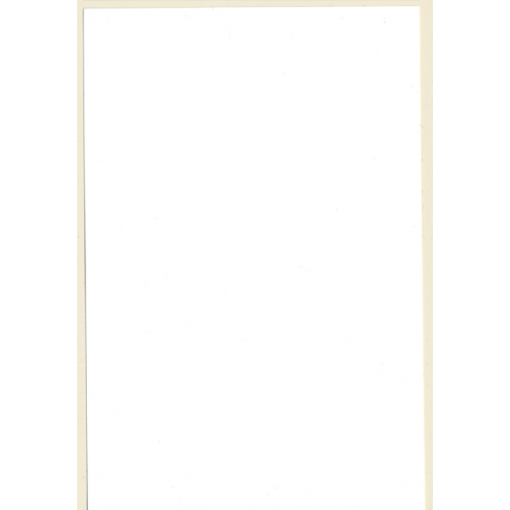 Erotic Study: Brunette Nude Getting Touched By Sunbeams*2 (Digital Photo Print 2000s)