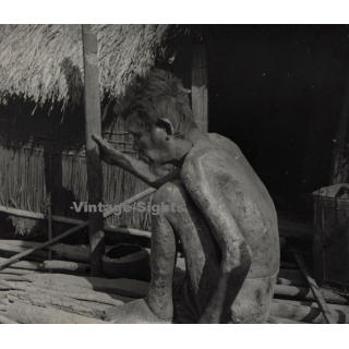 Vietnam: Sauvage Moï / Leper - Leprosy (Vintage Stereo Glass Plate ~1920s/1930s)
