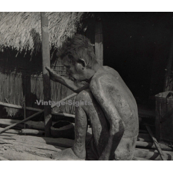 Vietnam: Sauvage Moï / Leper - Leprosy (Vintage Stereo Glass Plate ~1920s/1930s)