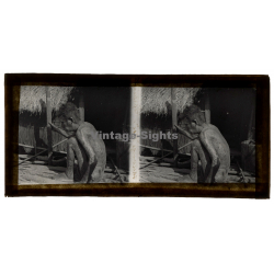 Vietnam: Sauvage Moï / Leper - Leprosy (Vintage Stereo Glass Plate ~1920s/1930s)