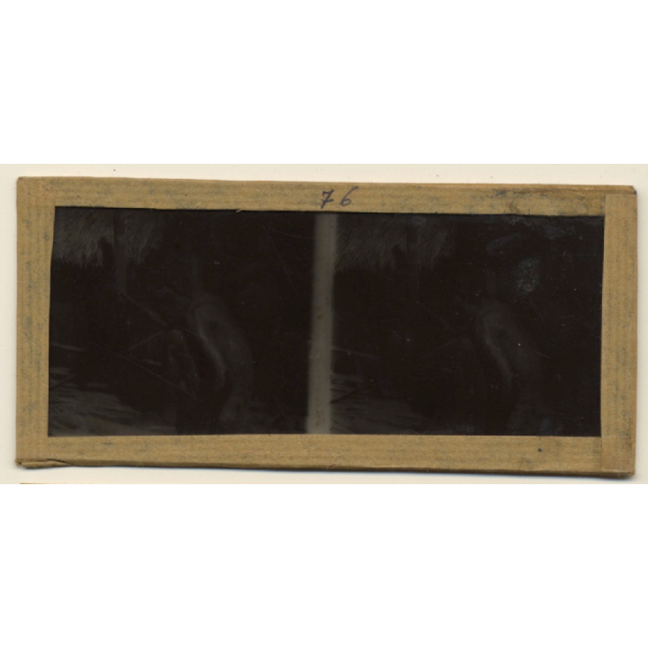 Vietnam: Sauvage Moï / Leper - Leprosy (Vintage Stereo Glass Plate ~1920s/1930s)