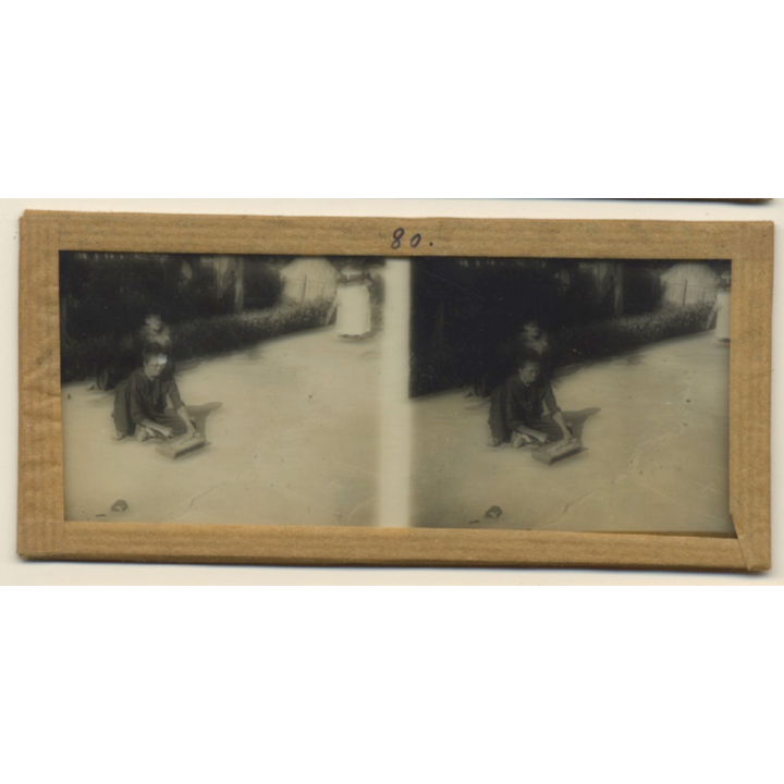 Vietnam: Indigenous Moï In Leper Colony / Leprosy (Vintage Stereo Glass Plate ~1920s/1930s)