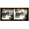 Vietnam: Lepers Roll A Cigarette *2 / Leprosy Colony (Vintage Stereo Glass Plate ~1920s/1930s)
