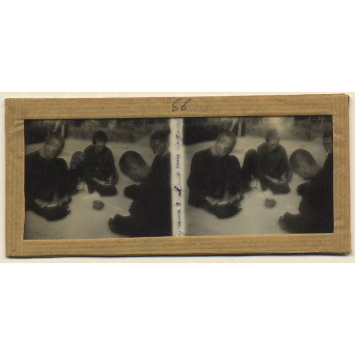Vietnam: Lepers Roll A Cigarette *2 / Leprosy Colony (Vintage Stereo Glass Plate ~1920s/1930s)
