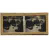 Vietnam: Lepers Roll A Cigarette *2 / Leprosy Colony (Vintage Stereo Glass Plate ~1920s/1930s)