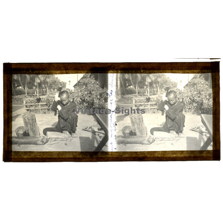 Vietnam: Leper Sufferer Chops Wood / Leprosy Colony (Vintage Stereo Glass Plate ~1920s/1930s)