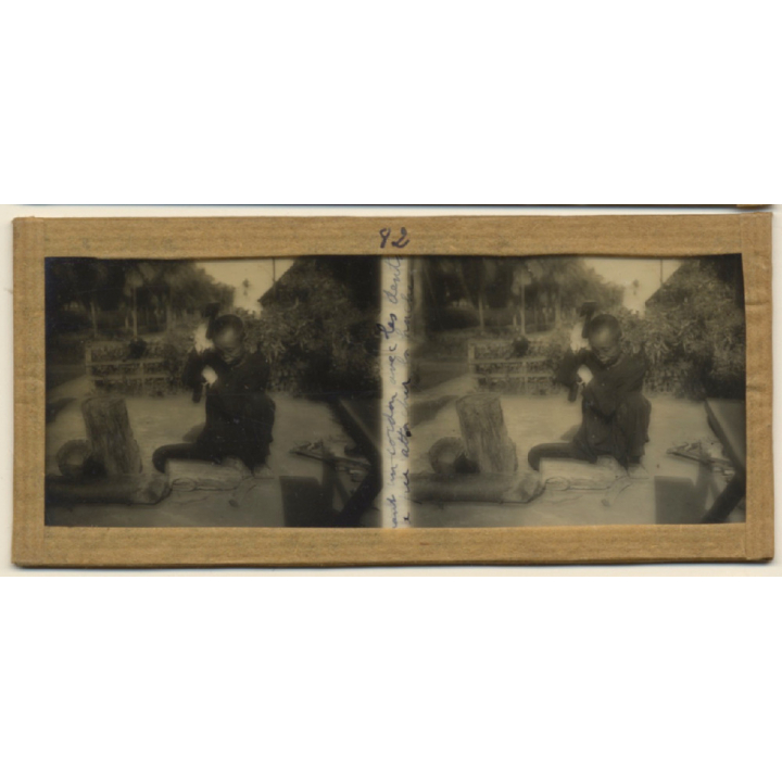 Vietnam: Leper Sufferer Chops Wood / Leprosy Colony (Vintage Stereo Glass Plate ~1920s/1930s)