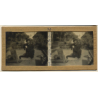 Vietnam: Leper Sufferer Chops Wood / Leprosy Colony (Vintage Stereo Glass Plate ~1920s/1930s)