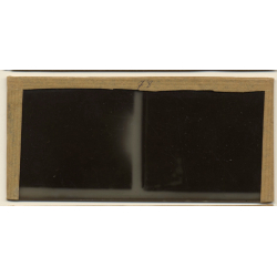 Vietnam: Woman Severely Suffering From Leprosy / Leper (Vintage Stereo Glass Plate ~1920s/1930s)