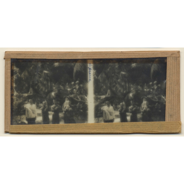 Vietnam: Missionary & Leper In Leprosy Colony (Vintage Stereo Glass Plate ~1920s/1930s)