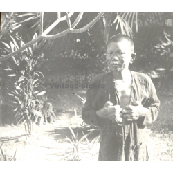 Vietnam: Nativ Moï Suffering From Leprosy / Leper (Vintage Stereo Glass Plate ~1920s/1930s)