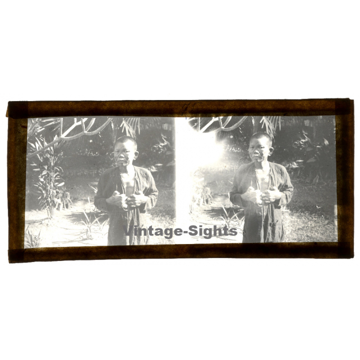 Vietnam: Nativ Moï Suffering From Leprosy / Leper (Vintage Stereo Glass Plate ~1920s/1930s)