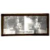 Vietnam: Nativ Moï Suffering From Leprosy / Leper (Vintage Stereo Glass Plate ~1920s/1930s)