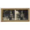 Vietnam: Nativ Moï Suffering From Leprosy / Leper (Vintage Stereo Glass Plate ~1920s/1930s)