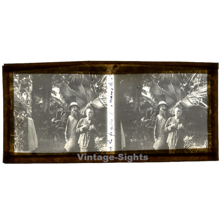 Vietnam: Missionary & Nativ Moï Suffering From Leprosy (Vintage Stereo Glass Plate ~1920s/1930s)