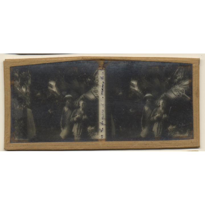Vietnam: Missionary & Nativ Moï Suffering From Leprosy (Vintage Stereo Glass Plate ~1920s/1930s)