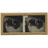 Vietnam: Native Lepers Playing Cards / Leprosy Colony (Vintage Stereo Glass Plate ~1920s/1930s)