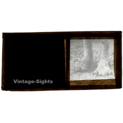 Vietnam: Close-up Of Of Feet Of Leper / Leprosy Colony (Vintage Stereo Glass Plate ~1920s/1930s)