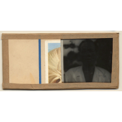 Vietnam: Moï Severely Suffering From Leprosy / Leper Colony (Vintage Stereo Glass Plate ~1920s/1930s)