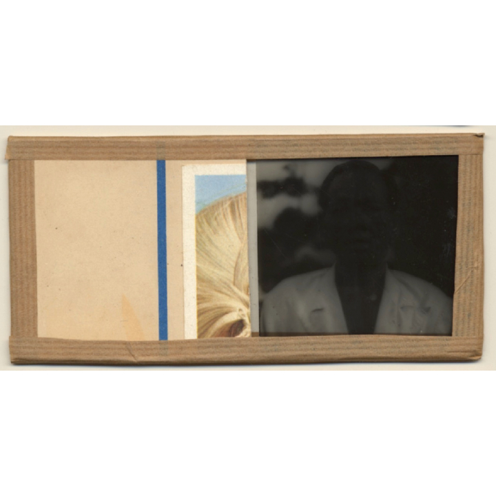 Vietnam: Moï Severely Suffering From Leprosy / Leper Colony (Vintage Stereo Glass Plate ~1920s/1930s)