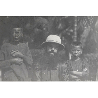 Vietnam: French Missionary With 2 Native Kids With Leprosy (Vintage Glass Plate ~1920s/1930s)