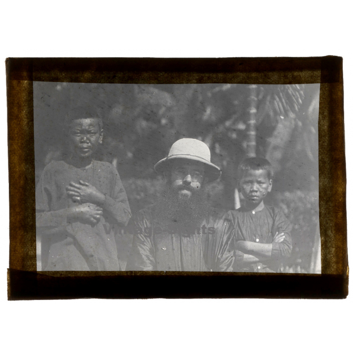 Vietnam: French Missionary With 2 Native Kids With Leprosy (Vintage Glass Plate ~1920s/1930s)