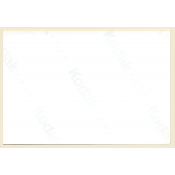 Erotic Study: Close-up Of Nude Curlyheads' Boobs & Armpit (Vintage Photo ~1990s)