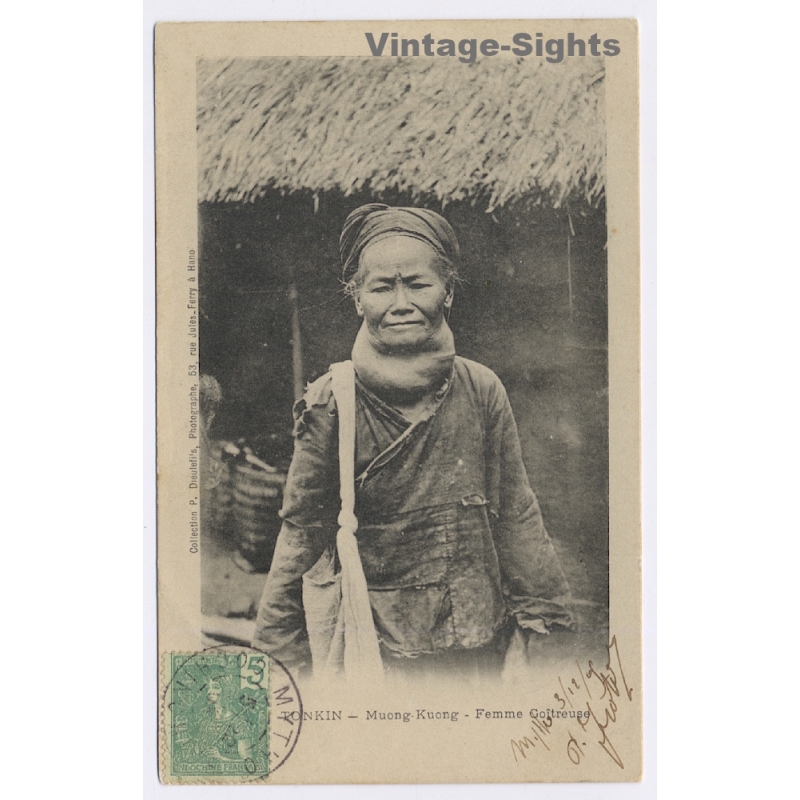 Tonkin: Muong Kuong - Femme Goîtreuse / Dieulefils - Ethnic (Vintage PC 1904)