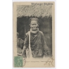 Tonkin: Muong Kuong - Femme Goîtreuse / Dieulefils - Ethnic (Vintage PC 1904)