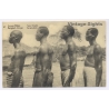 Congo Belge: Type Bangala / Ethnic - Tribal Scars (Vintage Postal Stationery1910s)