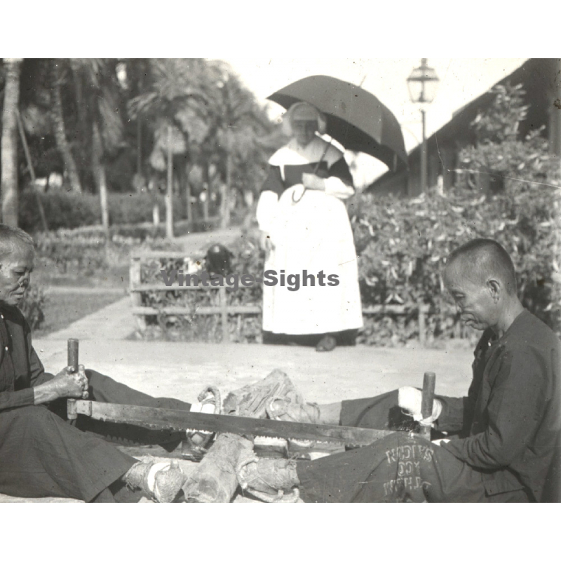 Vietnam: Lepers Saw A Tree Trunk / Missionary Sister (Vintage Stereo Glass Plate ~1920s/1930s)