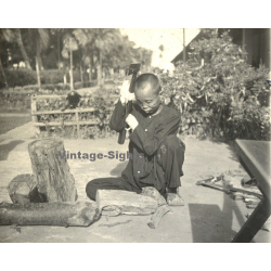 Vietnam: Leper Sufferer Chops Wood / Leprosy Colony (Vintage Stereo Glass Plate ~1920s/1930s)