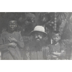 Vietnam: French Missionary With 2 Native Kids With Leprosy (Vintage Glass Plate ~1920s/1930s)