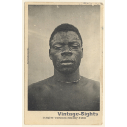 Congo Belge: Indigène Turumbu (Stanley Falls) / Tribal Scars - Ethnic (Vintage PC 1910)