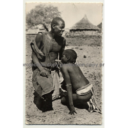Tchad / Africa: Ventouse Indigène / Son Cupping Father / Schröpfen (Vintage RPPC 1958)